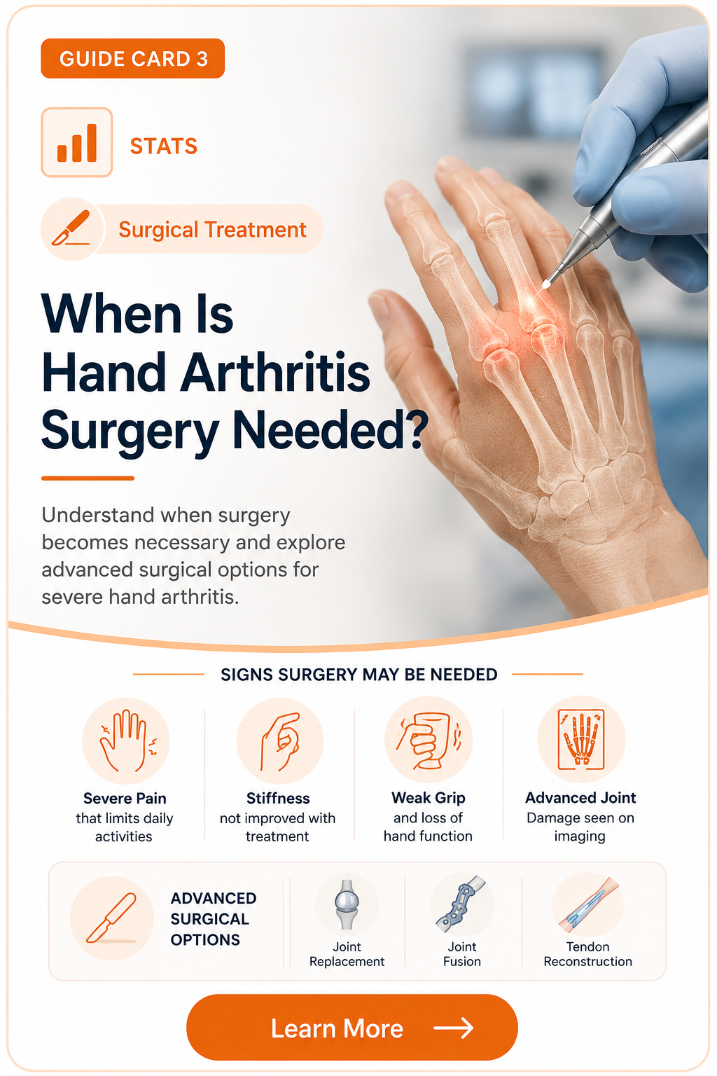 When Is Hand Arthritis Surgery Needed?
