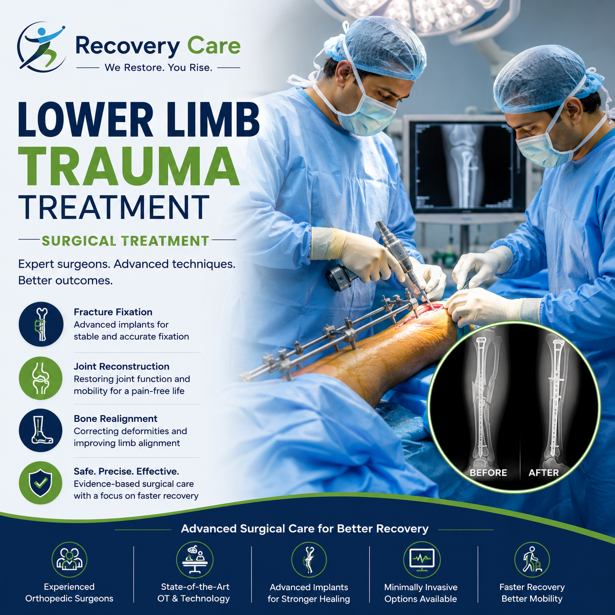 Surgical Treatment